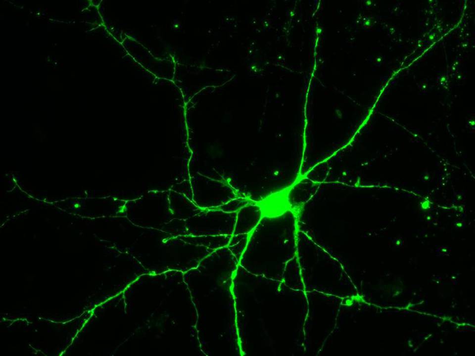 Primary Mouse Neurons in Adherence